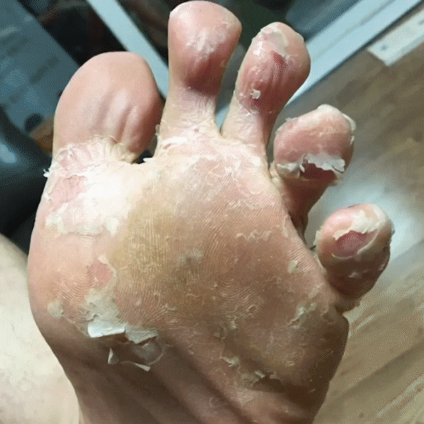 Good-bye Dirty Foot Solution | Exfoliate