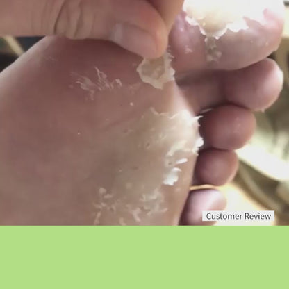 Good-bye Dirty Foot Solution | Exfoliate